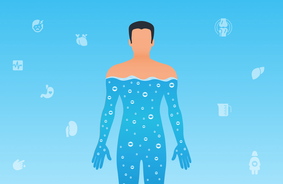 Hydration tips for people with certain health conditions